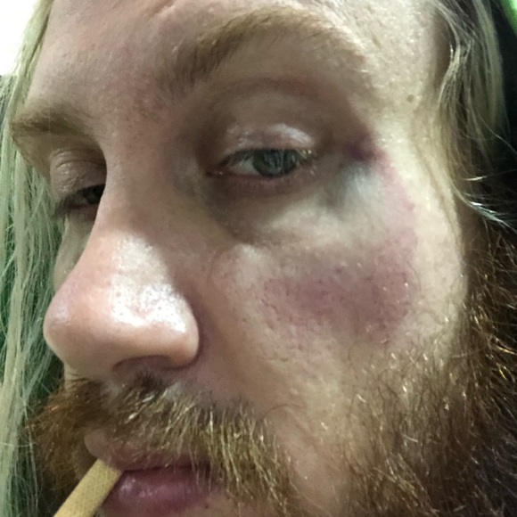 Meet your Posher, Vomit - Picture 1 of 1